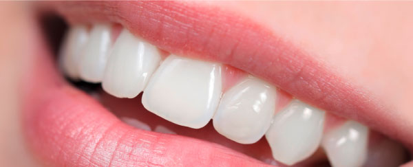 Nahaufnahme eines leicht geöffneten Mundes einer Patientin bei einer routinemäßigen Untersuchung des Zahnfleischs.