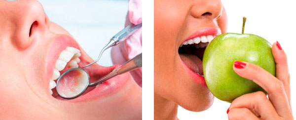 Nahaufnahme des Mundes einer Patientin, die mit Zahnarztbesteck untersucht wird und Nahaufnahme einer Patientin, wie sie in einen grünen Apfel beißt.